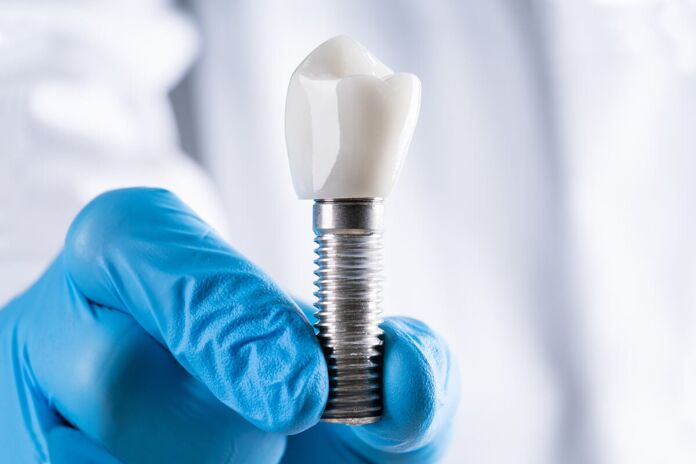 What are zygomatic implants and what are they for