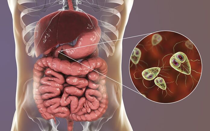 Giardiasis symptoms and treatment