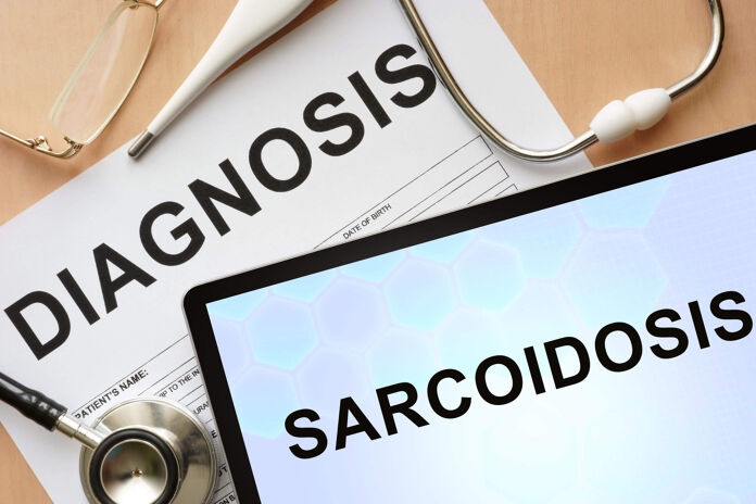 What is sarcoidosis symptoms and treatments