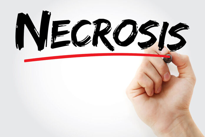 Diagnosis of skin necrosis