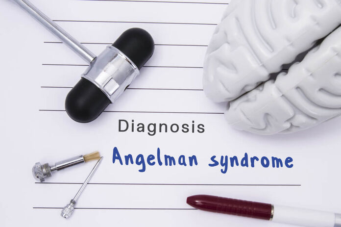 What is Angelman syndrome and is it treated