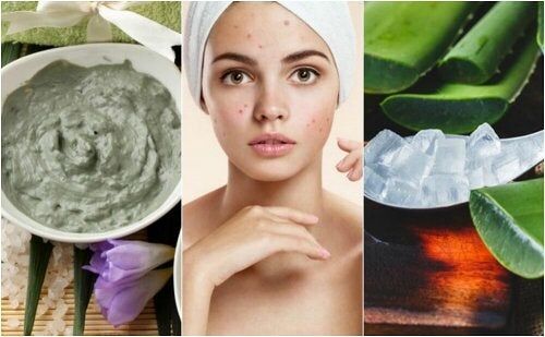 natural treatments for pimples on the face