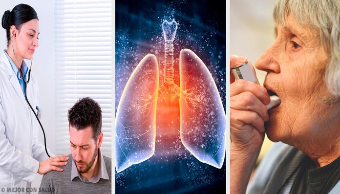 Treatment of pulmonary emphysema