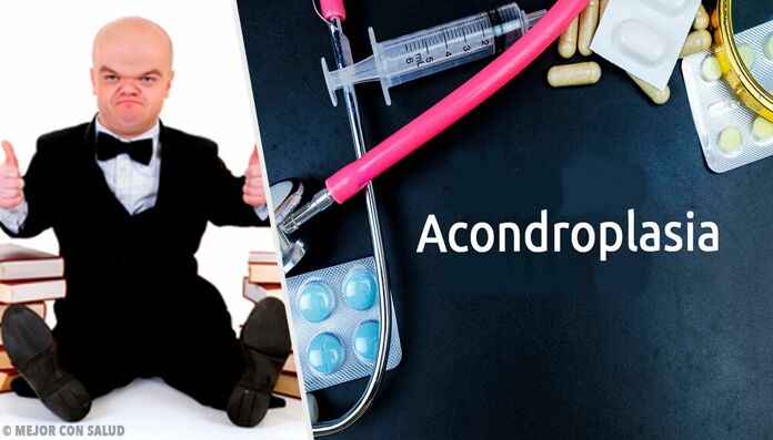 Treatment of achondroplasia