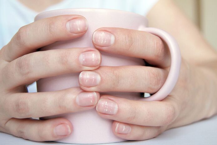 Health problems that the lunulae of your nails warn you