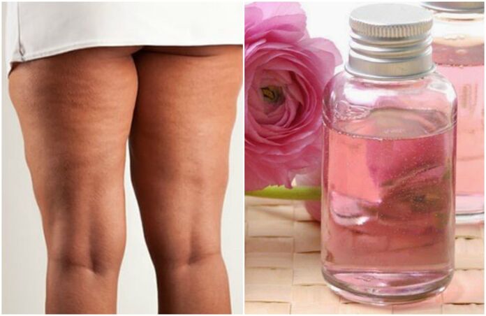 How to prepare an anti cellulite and firming lotion with essential