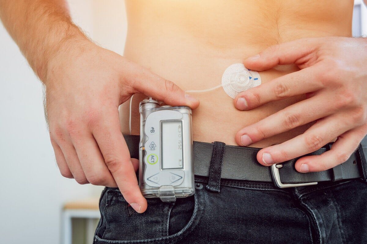 what-is-an-insulin-infusion-pump-health-wellness-2023